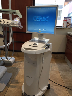 CEREC | Brian Yee DDS - Cleveland, OH
