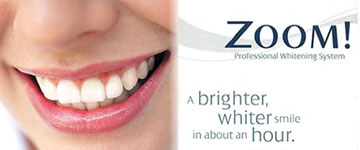 Zoom! Whitening | Brian Yee DDS | Cleveland OH 44114